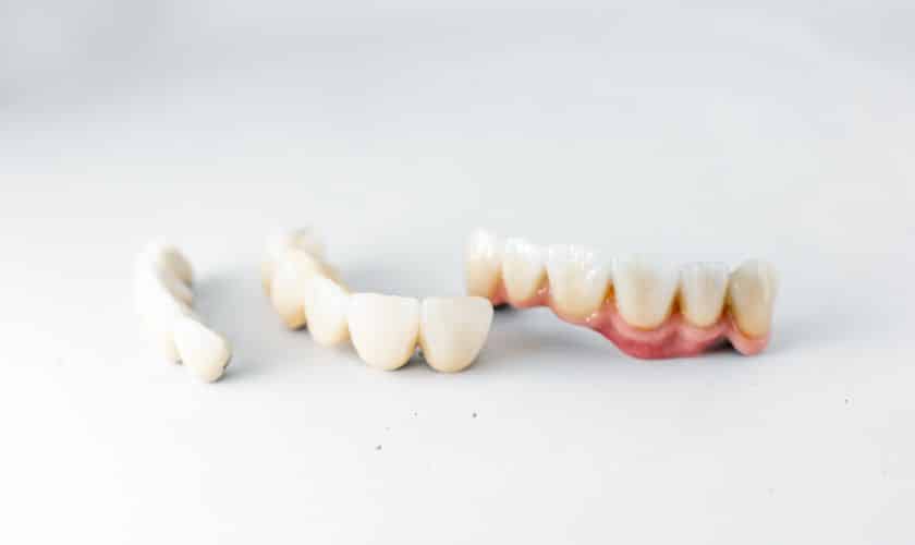 Reveal Your Radiant Smile: The Benefits of Dental Crown Lengthening - Briq Dental & Orthodontics